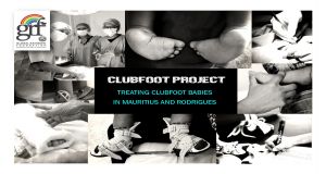 Clubfoot Project