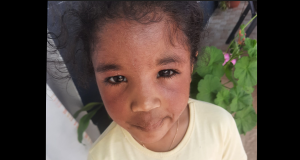 Please help Iris for her treatment in Reunion Island